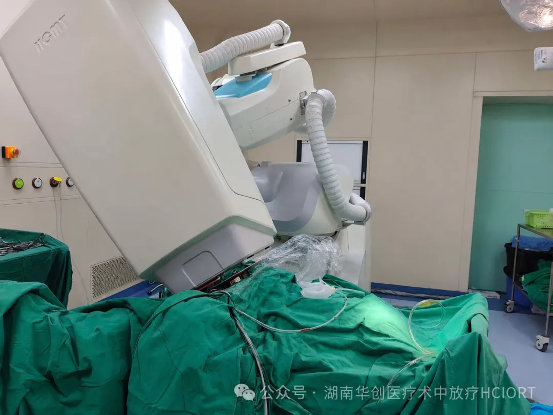 全球首例！南华大学附一院顺利完成外阴癌电子线球形施治器术中放疗