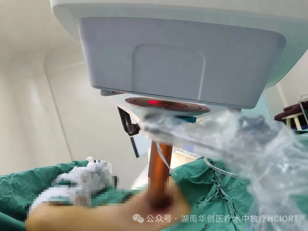 湖南首例！南华大学附一院顺利完成腋窝脂肪肉瘤电子束术中放疗