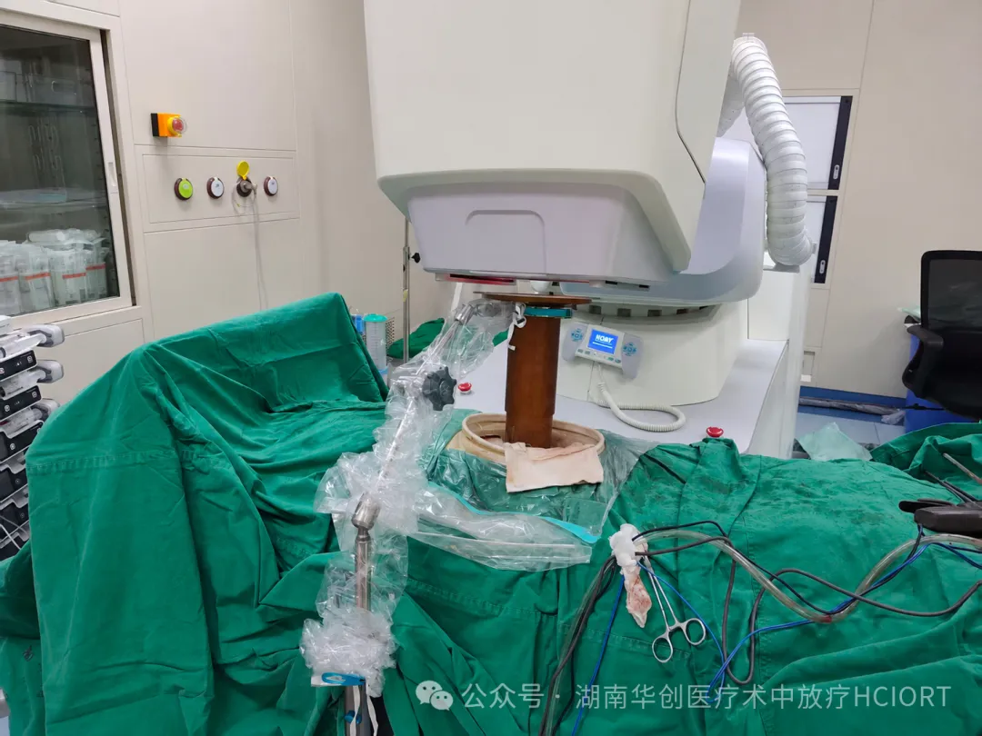 湖南首例！南华大学附一院在一台腹膜后肿瘤手术中顺利完成了两个病灶、两个照射野的术中放疗