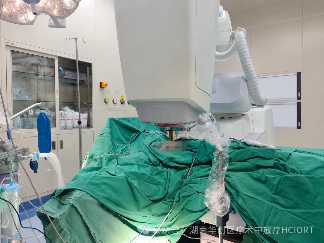 使用高剂量率电子线球形施治器，南华大学附一院顺利完成两例乳腺癌术中放疗