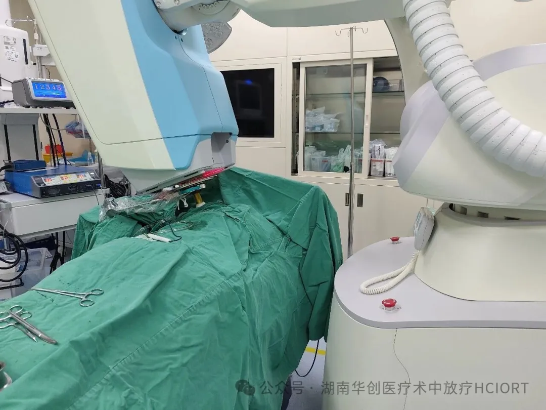使用高剂量率电子线球形施治器，南华大学附一院顺利完成两例乳腺癌术中放疗